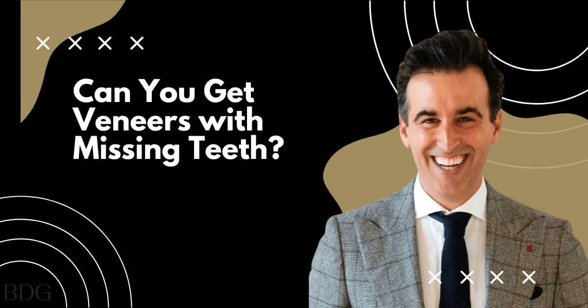 Can You Get Veneers with Missing Teeth?