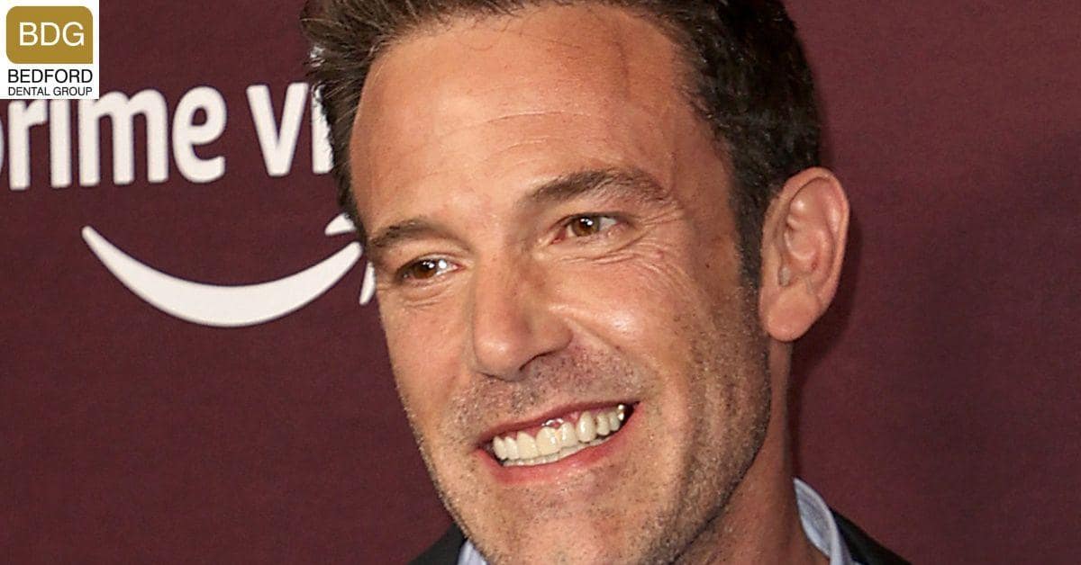 Ben Affleck's Dentures