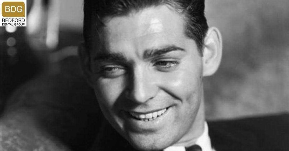 Clark Gable Dentures