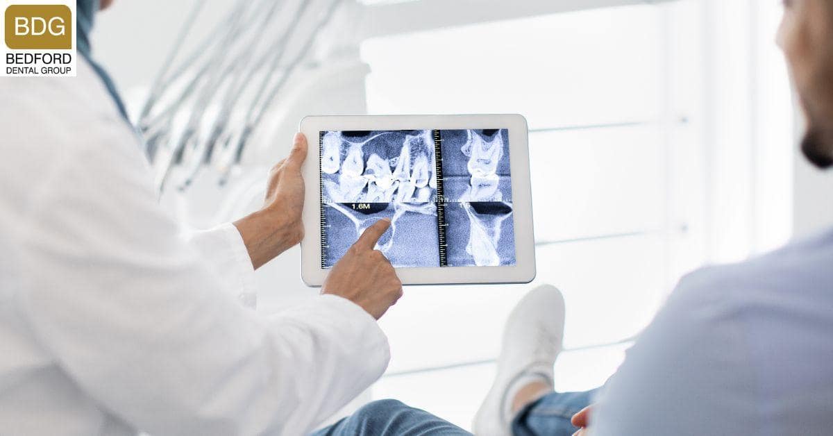 How to Ensure Your Veneers Last Long