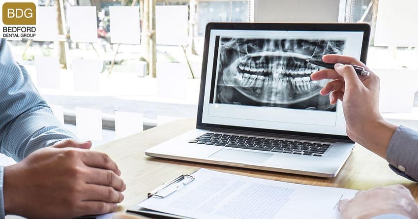 How-much-would-a-Hollywood-Smile-Cost-beverly-hills