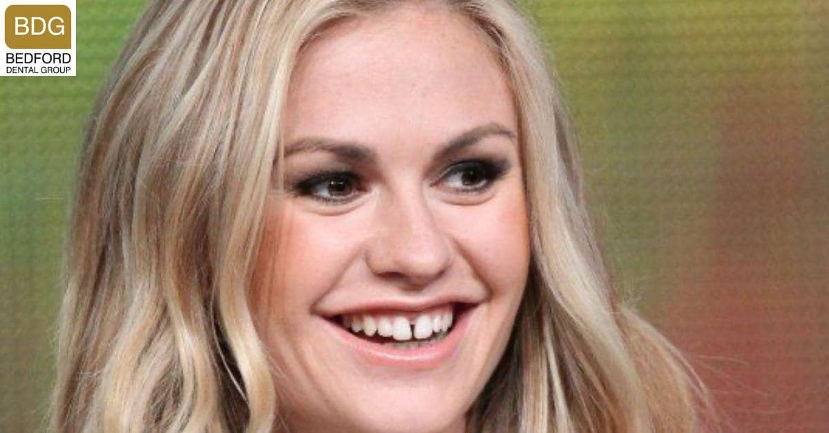 Anna Paquin's Teeth
