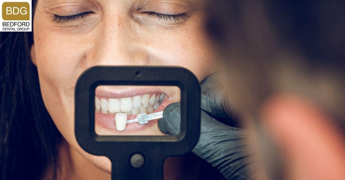Are Veneer Procedures Uncomfortable