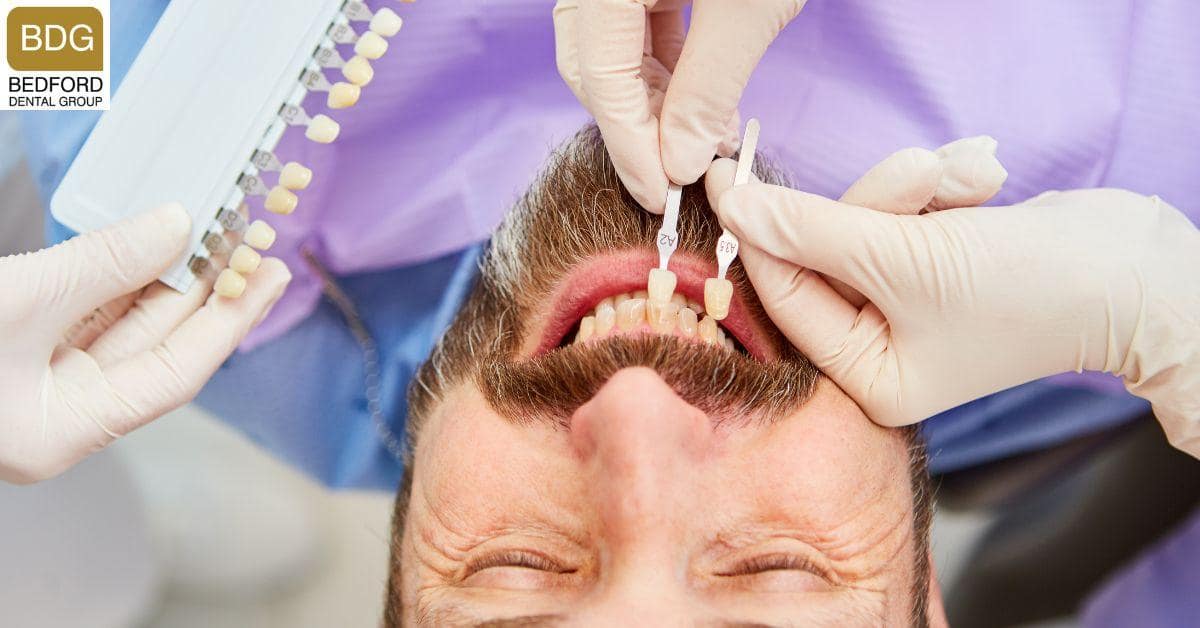 Are Veneers Difficult to Maintain