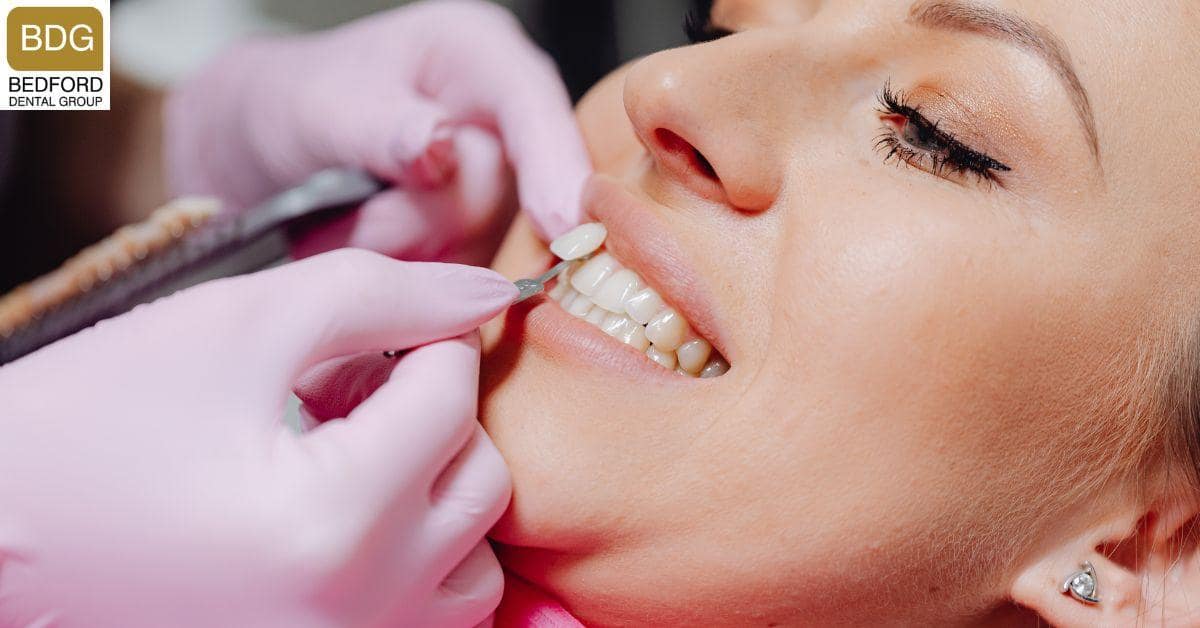 Composite Veneers vs Porcelain Veneers: What are the Differences?