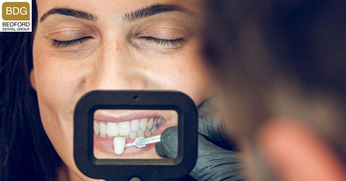 Easy Procedures to Boost Your Smile’s Production Value