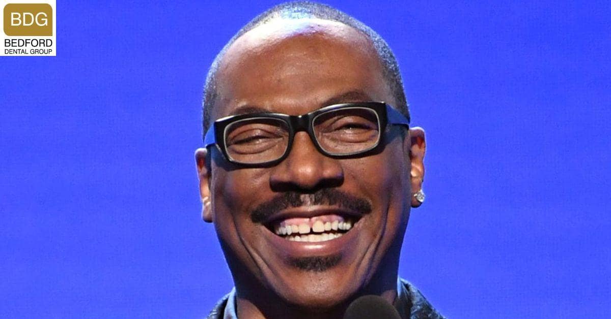 Eddie Murphy Teeth