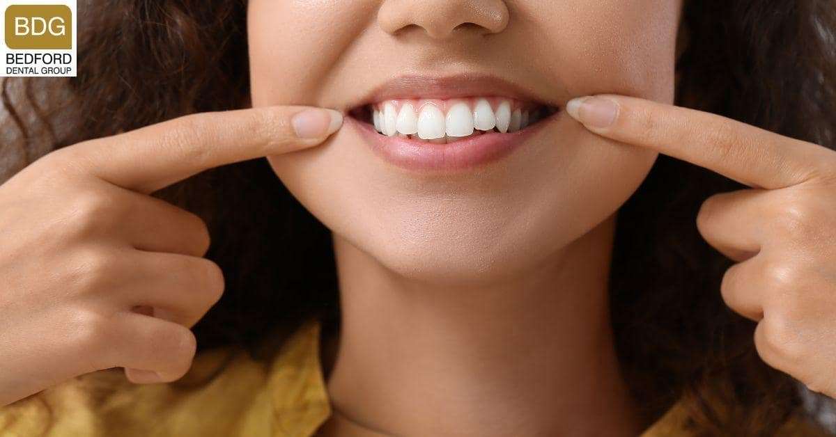 Getting that Perfect Hollywood Smile