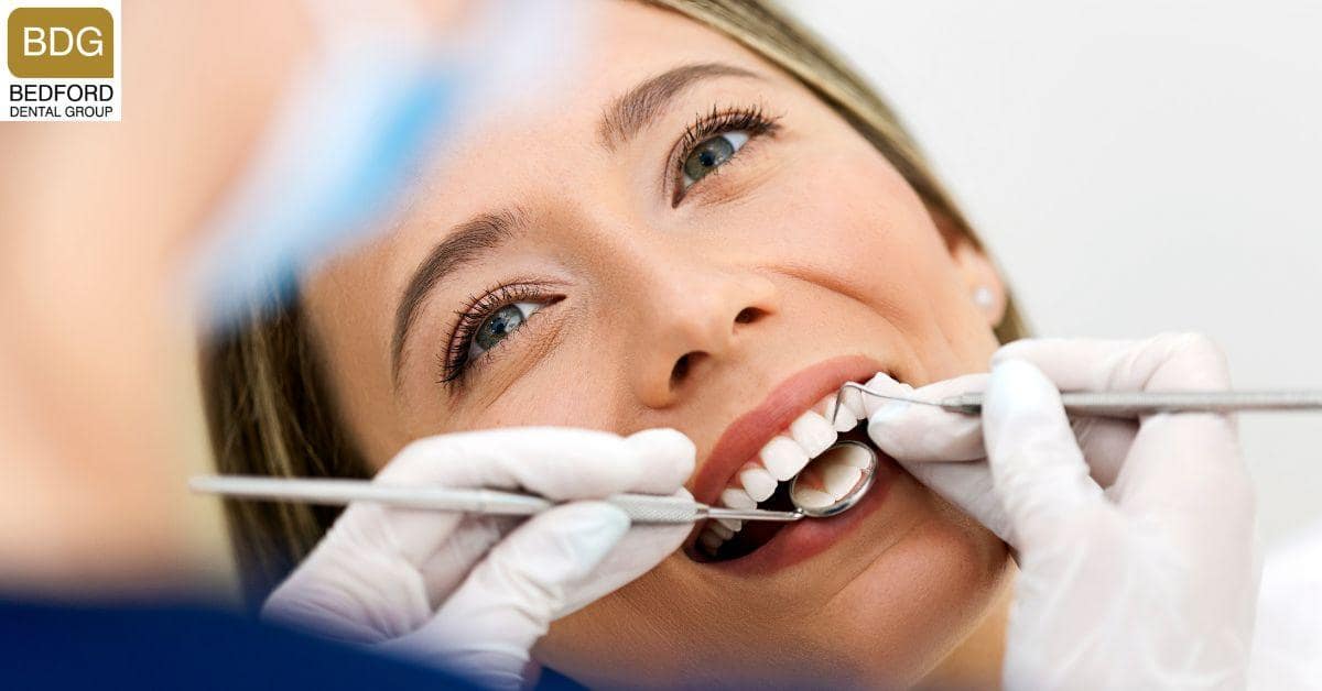 How Long do Veneers Last?
