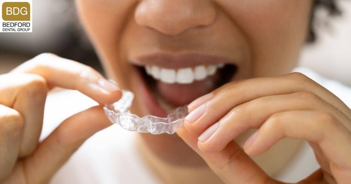 How to Care for Your Teeth After Getting Veneers