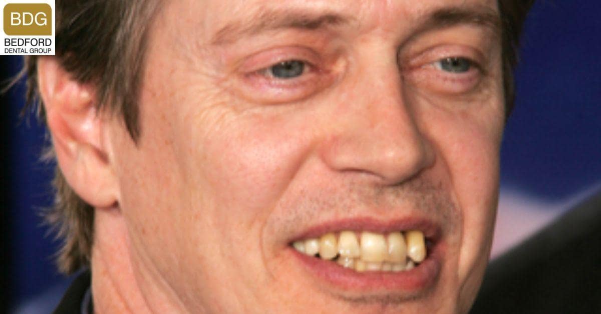 Steve Buscemi's Teeth