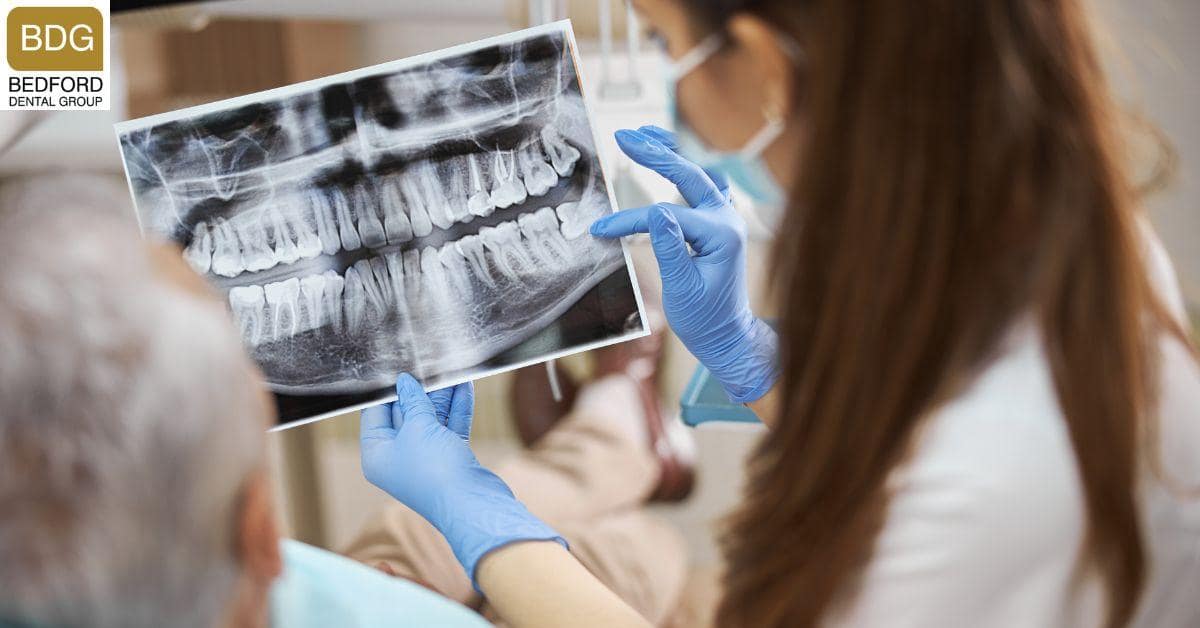 The Role Of Dental Imaging And Impressions In Planning Your Veneer Application