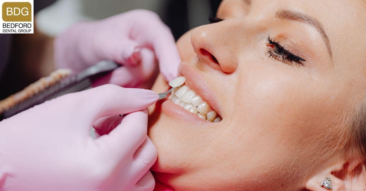 The Veneer Bonding Procedure