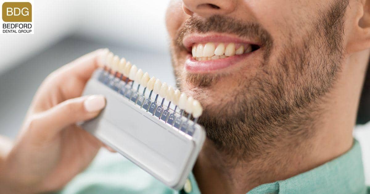 What Are Veneers?