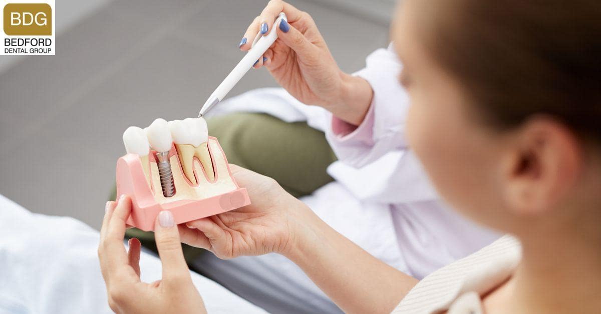 What Are Dental Implants?