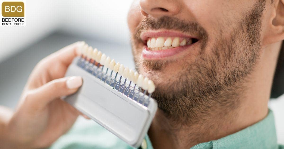 What are Veneers?