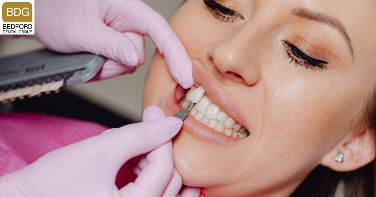 Why Do Dentists Shave Your Teeth for Veneers?